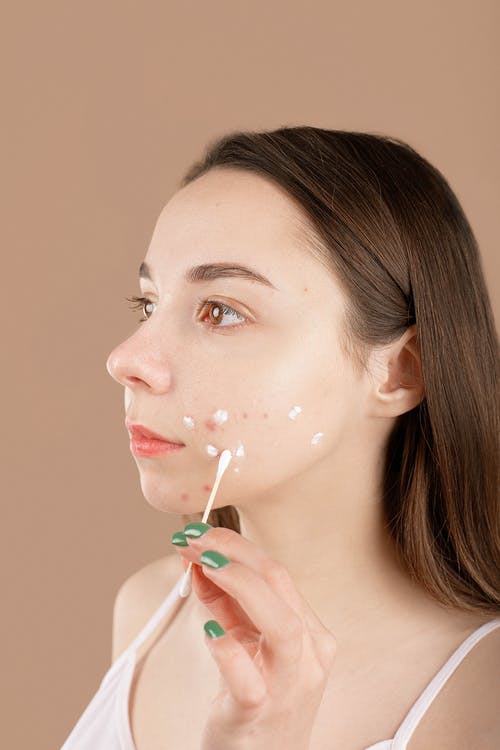 Treat Your Adult Acne